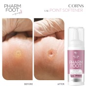 Point Softener 15ml